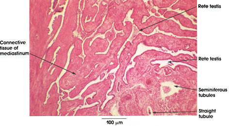 Plate 14.269 Testis