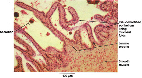 Plate 14.274 Seminal Vesicle