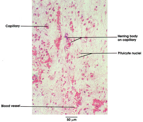 Plate 15.284 Pituitary Gland