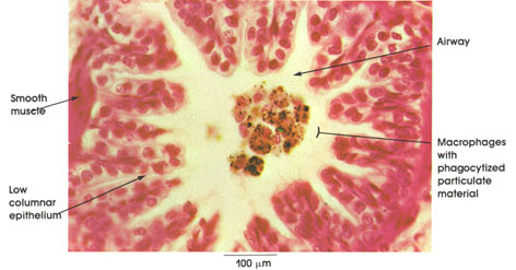 Plate 3.30: Macrophages