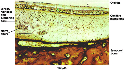 Plate 16.315 Macula Utriculi