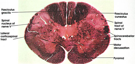 Plate 17.324 Medulla Oblongata