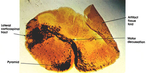 Plate 17.325 Medulla Oblongata