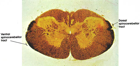 Plate 17.327 Medulla Oblongata