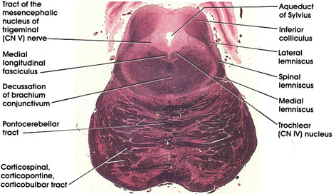 Plate 17.338 Mesencephalon