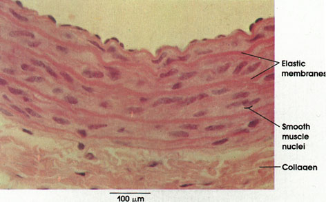 Plate 3.34: Elastic Membranes; Collagenous Fibers