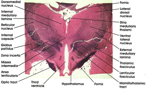 Plate 17.343 Diencephalon
