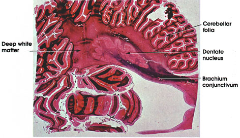 Plate 17.348 Cerebellum