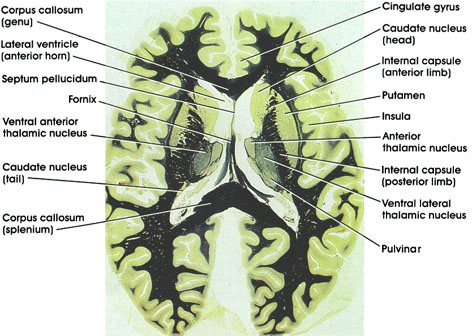 Plate 17.353 Striatum and Thalamus