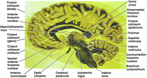 Plate 17.364 Section through Medial Thalamus