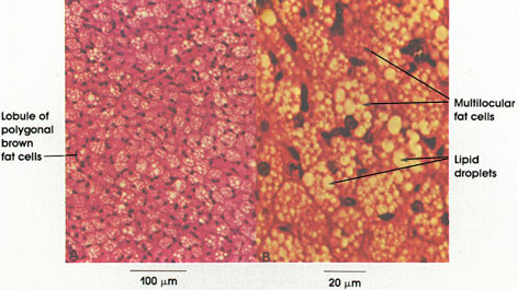 Plate 3.39: Brown Fat