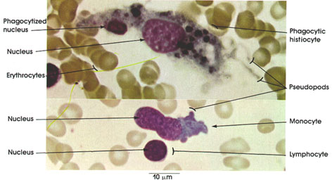 Plate 4.61: Bone Marrow