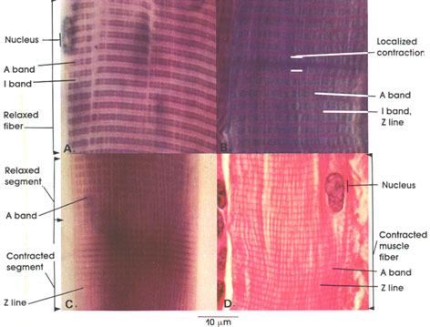 Plate 5.68: Striated Muscle