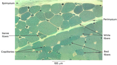 Plate 5.70: Striated Muscle