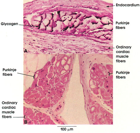 Plate 5.78: Purkinje Fibers