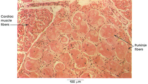 Plate 5.79: Cardiac Muscle