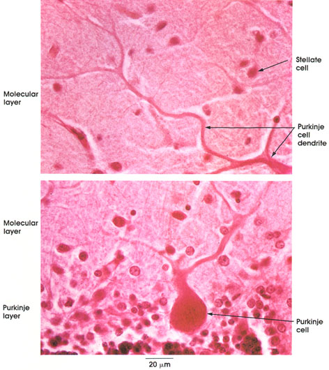 Plate 6.93 Cerebellum