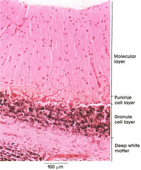 Plate 6.97 Cerebellum