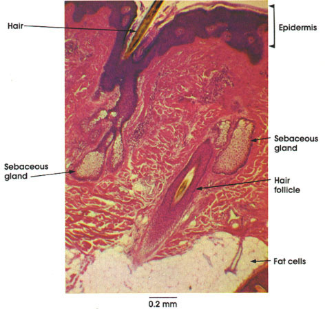 Plate 7.145 Scalp