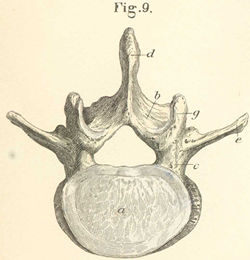 Lumbar vertebra