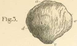 The left patella from the volar or anterior surface.