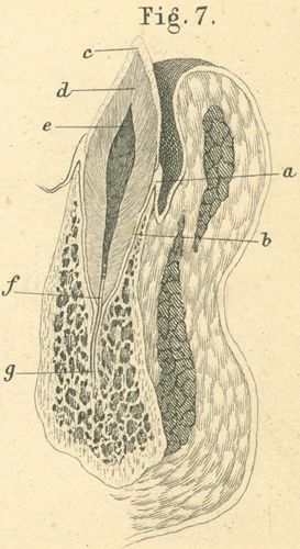 Tooth in-situ