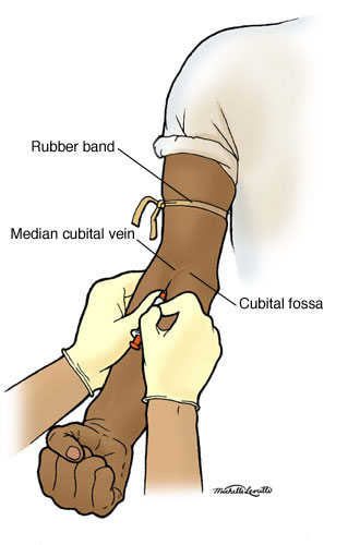 Injection Site  B